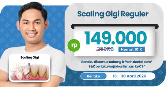 Scaling Gigi Regular